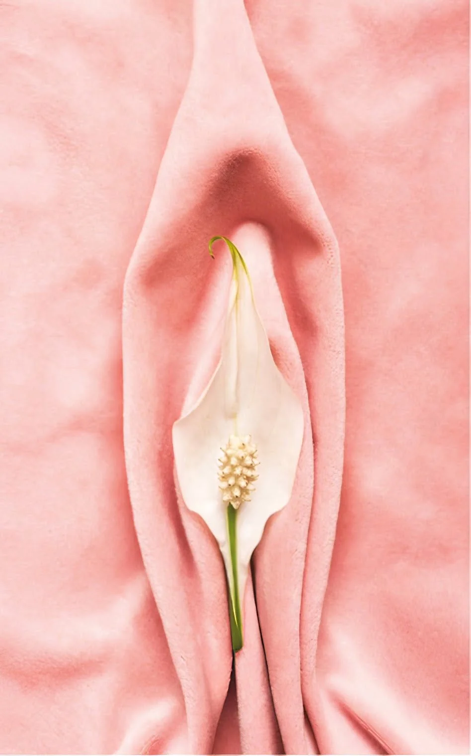 Ninfoplastia
